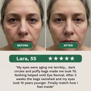 Eye Revival Complex - Erases Bags & Aging Eyes