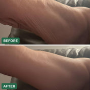 Crepey Skin Repair Cream