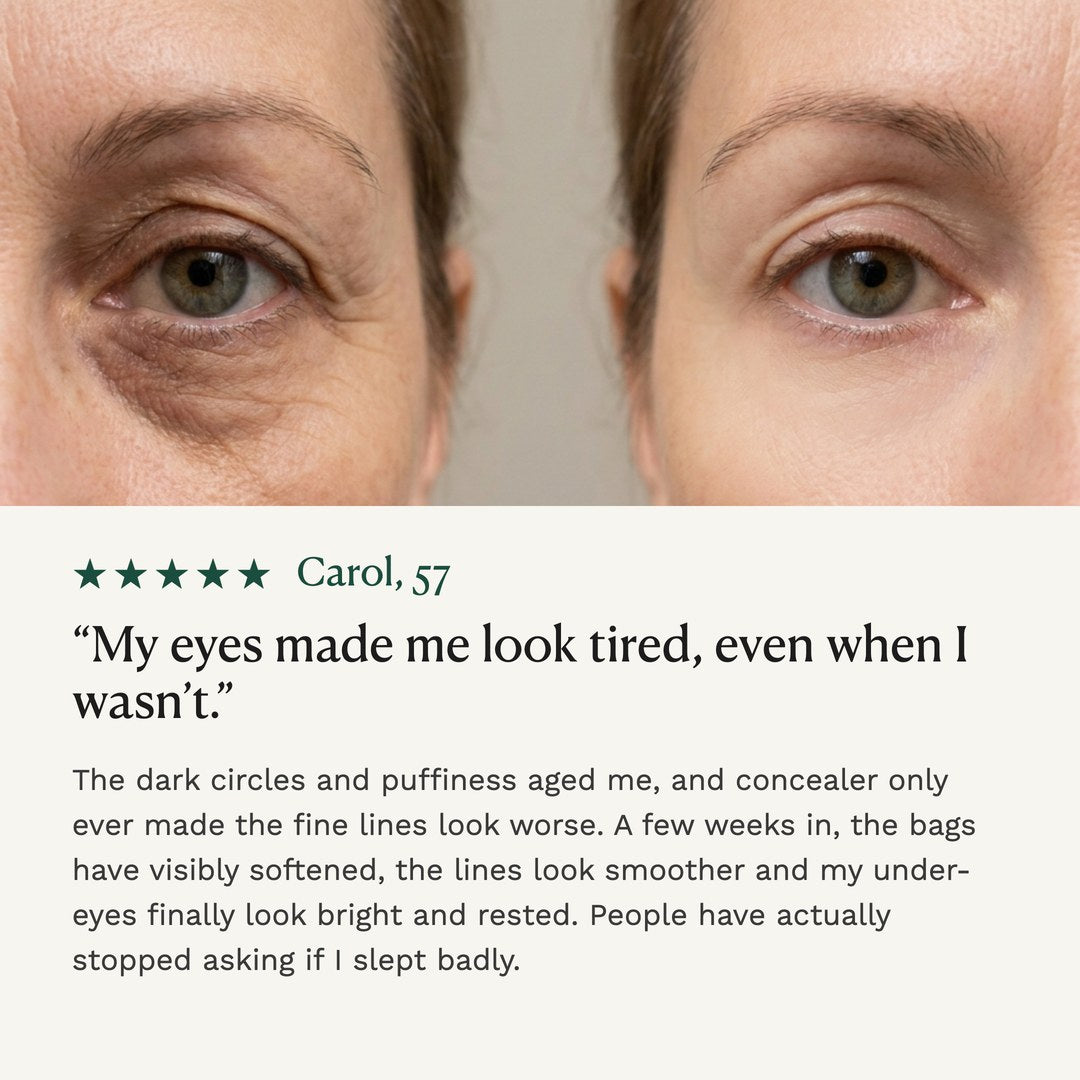 Peptide Firming Eye Cream | for Crow's Feet, Dark Circles & Puffiness