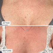 CELLU™ Magisches Körperöl – 100 ml