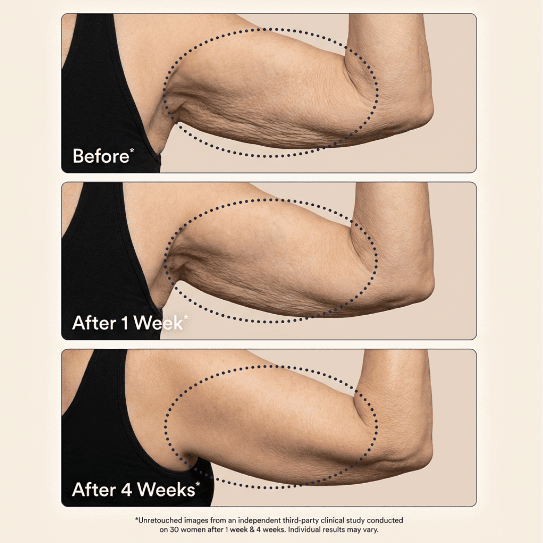 Crepey Skin Repair Cream