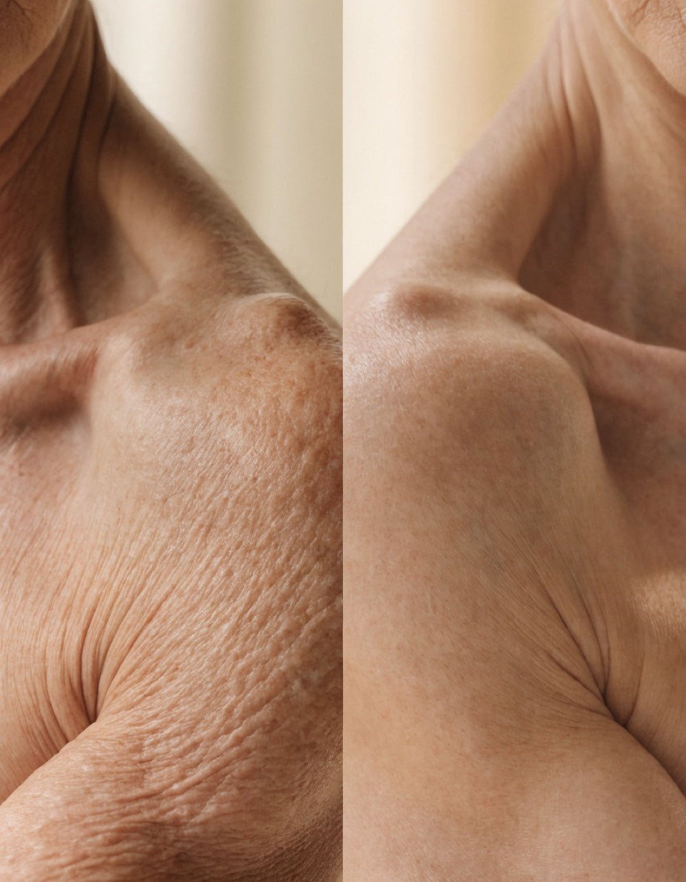 Mature woman body firming editorial